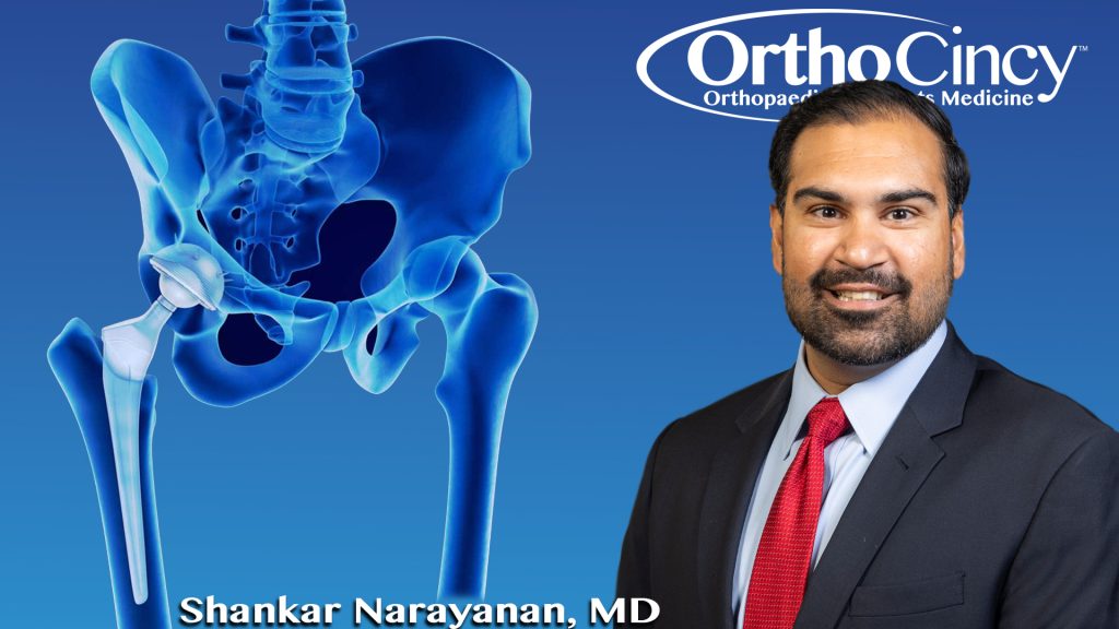 Dr. Narayanan Hip Replacement Thumbnail